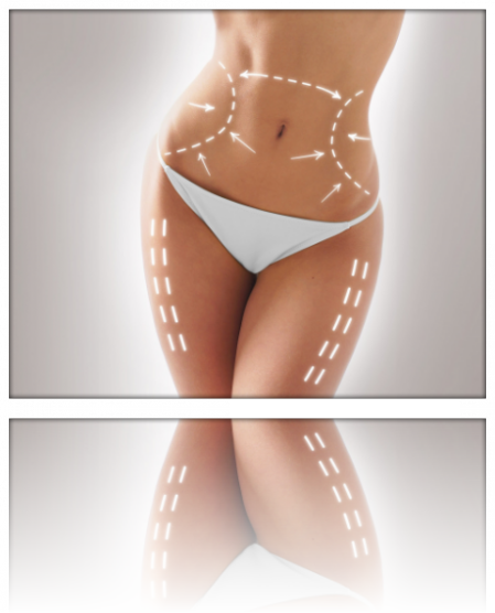 Lipoice Onda Ultrasonica Lipoice Onda Ultrasonica