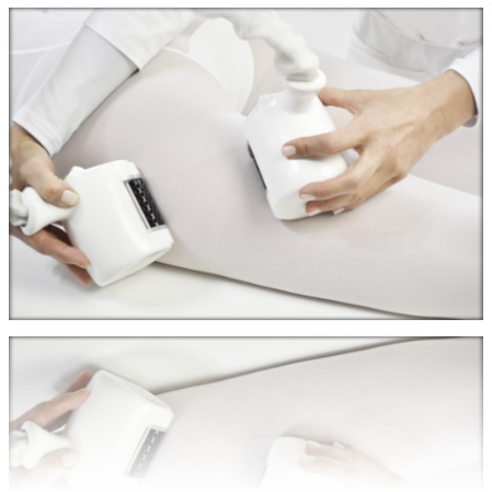 Icoone Laser Massaggio meccanico